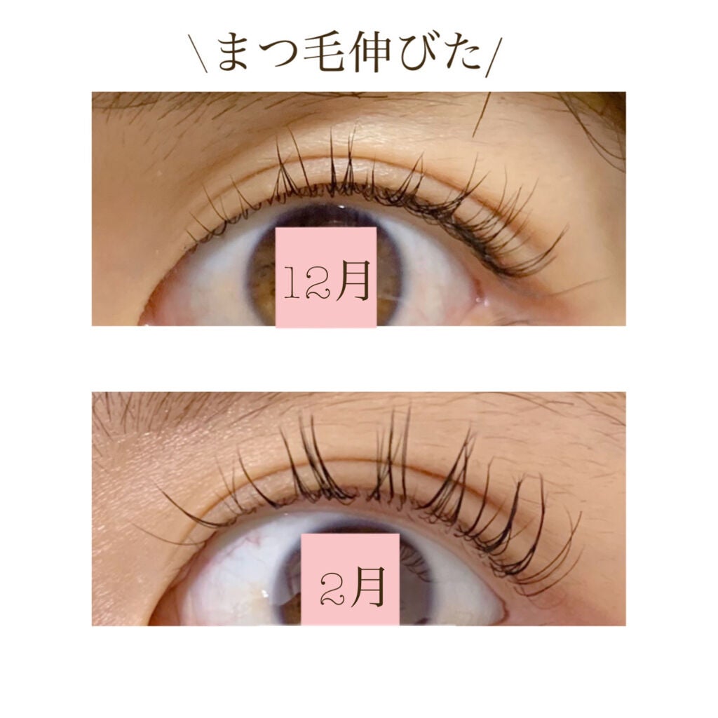ビューティーラッシュ オリジン/Spa treatment/まつげ美容液を使ったクチコミ(2枚目)