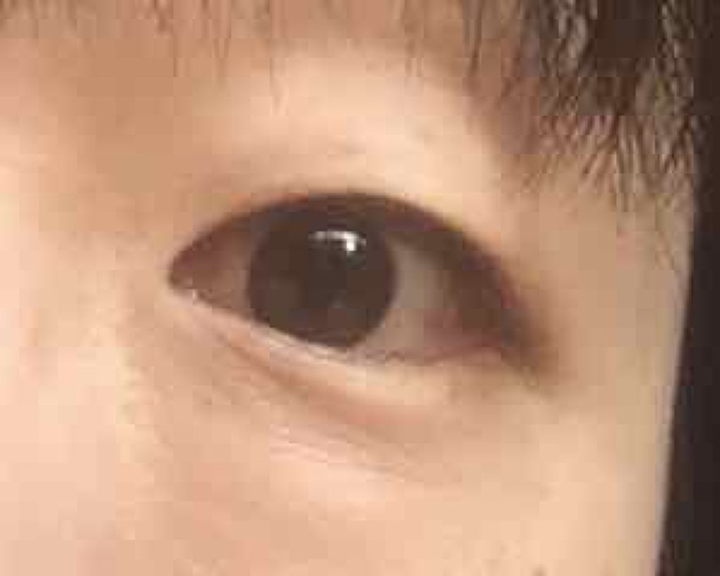 【旧品】オリシキ アイリッドスキンフィルム/D-UP/二重まぶた用アイテムを使ったクチコミ（2枚目）