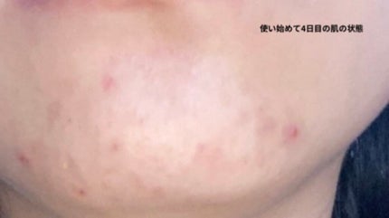 乳液・敏感肌用・高保湿タイプ/無印良品/乳液を使ったクチコミ(4枚目)