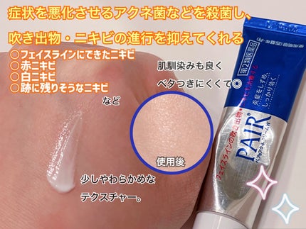 ペアアクネクリームW(医薬品)/ペア/その他を使ったクチコミ(2枚目)