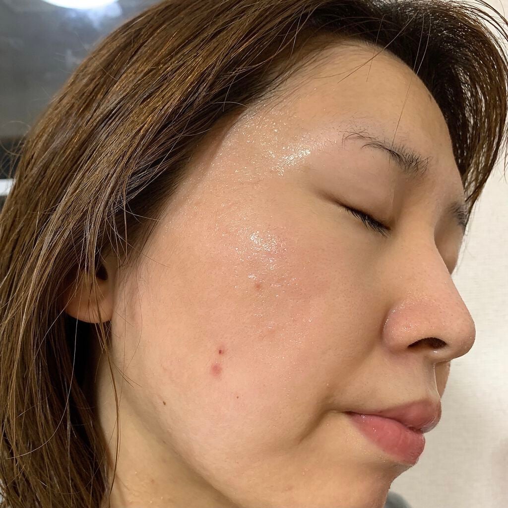 ãã©ã³ã·ã³ã°ïŒïŒ€ãã¹ã¯ ã¢ã€ã¹ãã£ãŒã»ã©ã /èçŸç²Ÿ/ã·ãŒããã¹ã¯ã»ããã¯ã䜿ã£ãã¯ãã³ãïŒ6æç®ïŒ