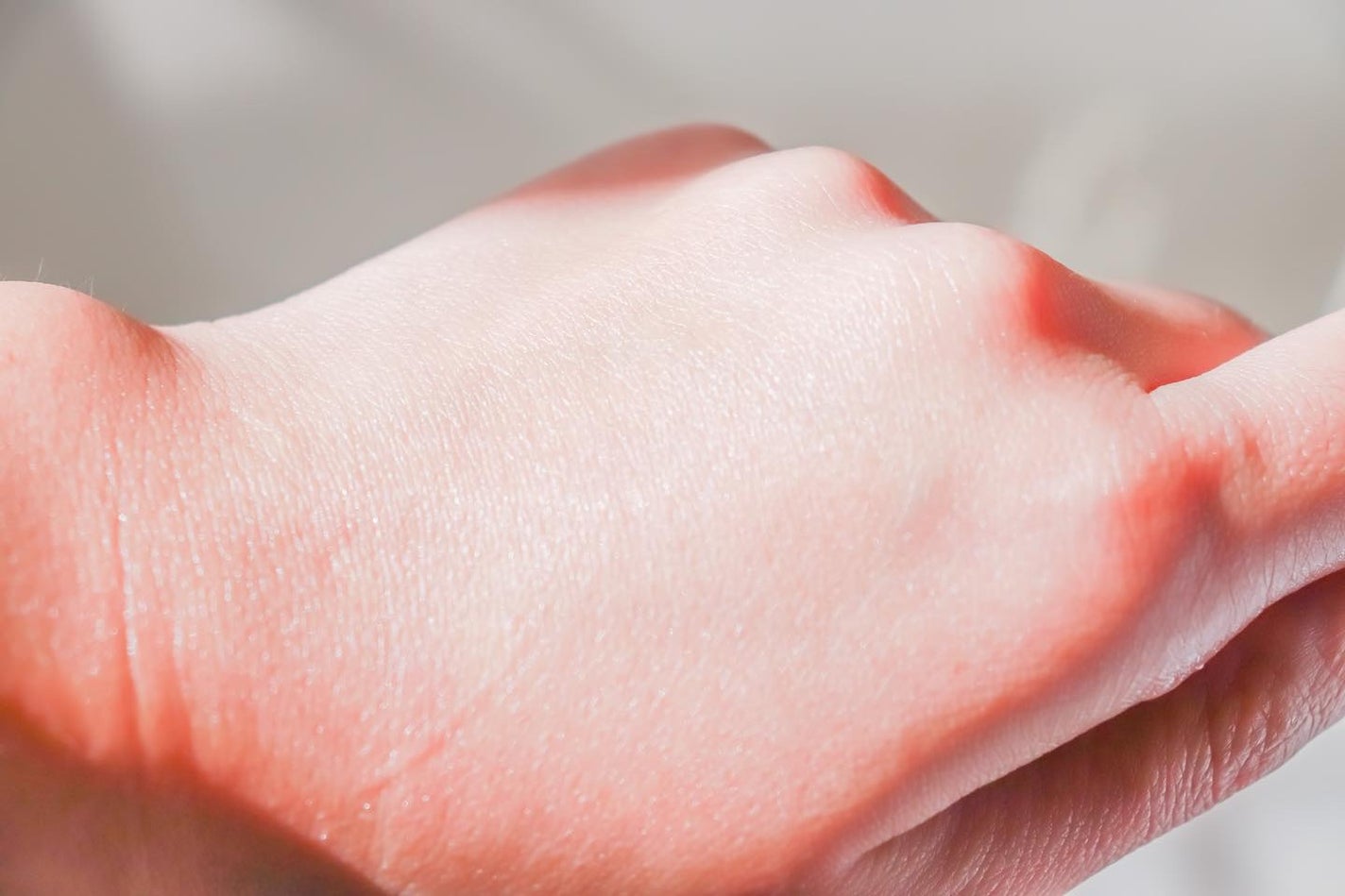 乾燥さん 薬用しっとり化粧液【医薬部外品】/乾燥さん/オールインワン化粧品を使ったクチコミ(4枚目)