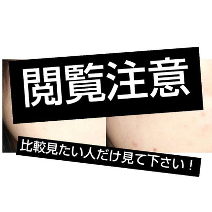 薬用 しみ 集中対策 美容液/メラノCC/美容液を使ったクチコミ(2枚目)