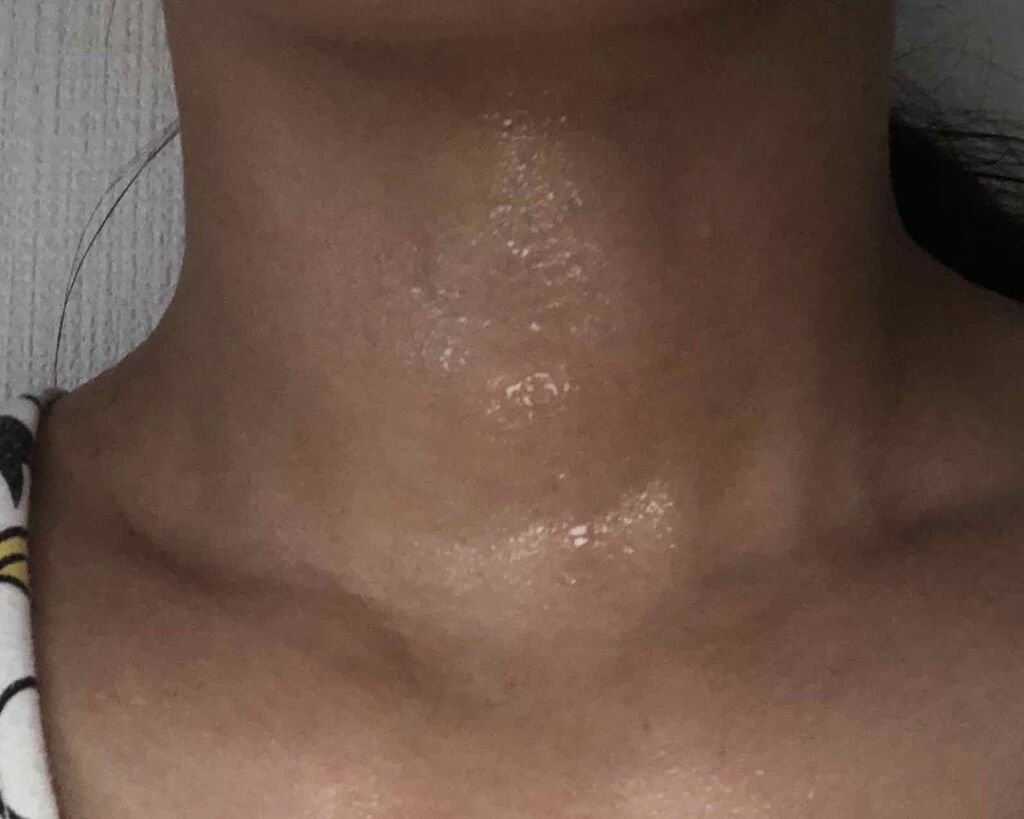 北の快適工房 ネックエステミストのクチコミ「日差しが強く、お部屋で過ごしていても目が痛くなるほどです。
熱中症に気をつけましょう💦

さて.....」（3枚目）