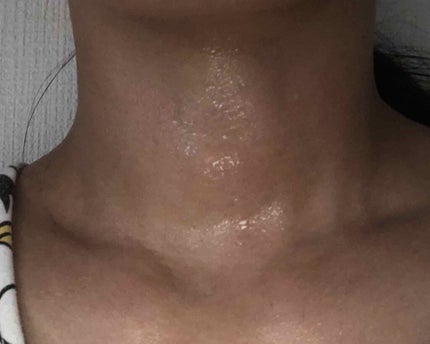 北の快適工房 ネックエステミストのクチコミ「日差しが強く、お部屋で過ごしていても目が痛くなるほどです。
熱中症に気をつけましょう💦
さて.....」(3枚目)