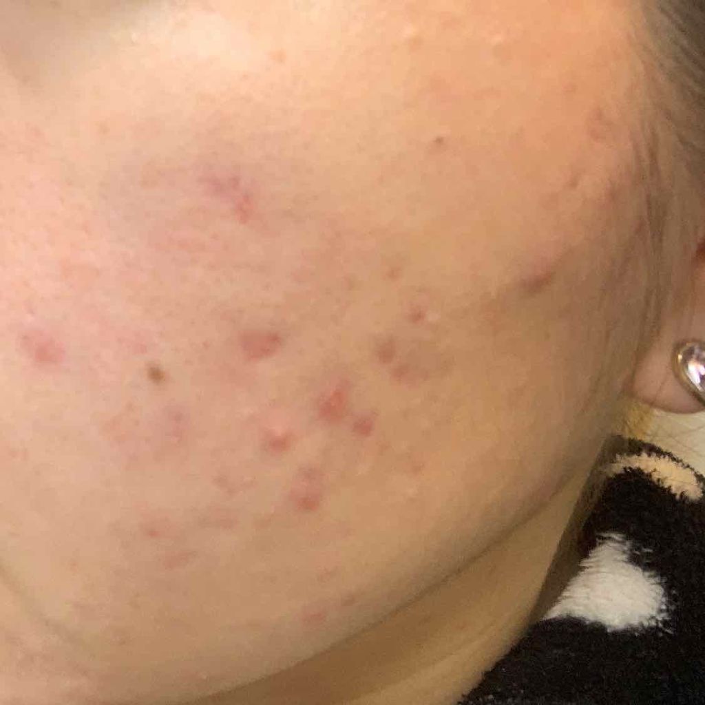 ドクタージャルト シカペア クリーム （第2世代）/Dr.Jart＋/フェイスクリームを使ったクチコミ（2枚目）