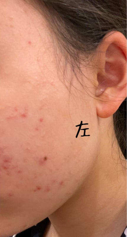 KINNGYOchanâð€ on LIPS ãä¹
ãã¶ãã§ã(˶ËË˶)/ååã®æçš¿ãšæ¯ã¹ããšâŠ(Õ..Õ)"..ãïŒ4æç®ïŒ