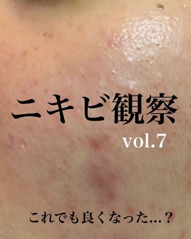 敏感肌用薬用美白美容液/無印良品/美容液を使ったクチコミ（1枚目）