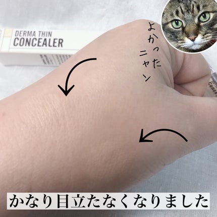 ダーマシンコンシーラー/23years old/リキッドコンシーラーを使ったクチコミ(8枚目)
