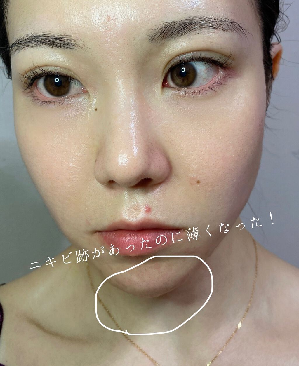 レチノールA 1% アドバンスドリバイタリゼーションクリーム/Life-flo/フェイスクリームを使ったクチコミ(5枚目)