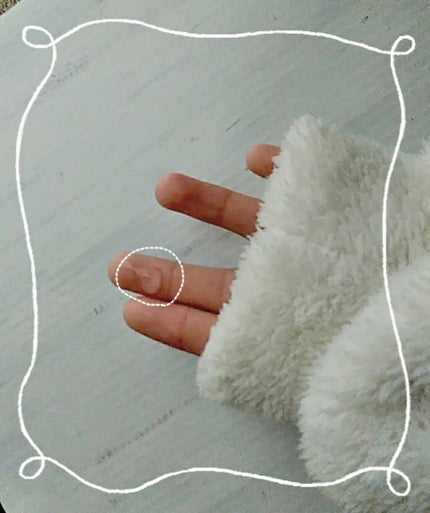 ローヤルゼリー配合 栄養ローション/DAISO/美容液を使ったクチコミ(2枚目)