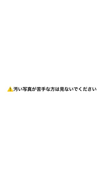 むぎ🌱 on LIPS 「とても悩んでるのでアドバイスが欲しいです…昔から鼻の毛穴の黒ず..」（1枚目）