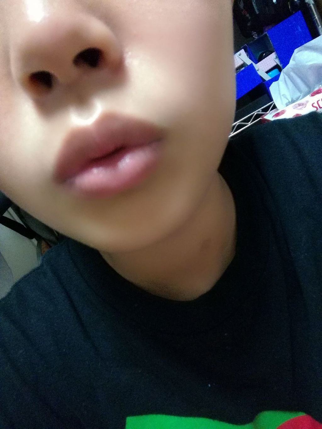 リップモイストエッセンス/DAISO/リップ美容液を使ったクチコミ（3枚目）