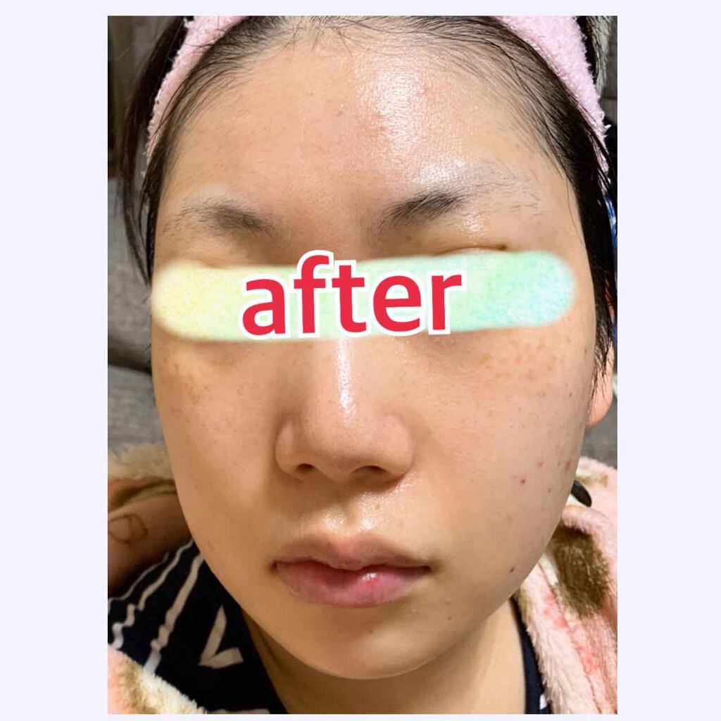 美肌マスク Ｃ/雪肌粋/シートマスク・パックを使ったクチコミ（3枚目）