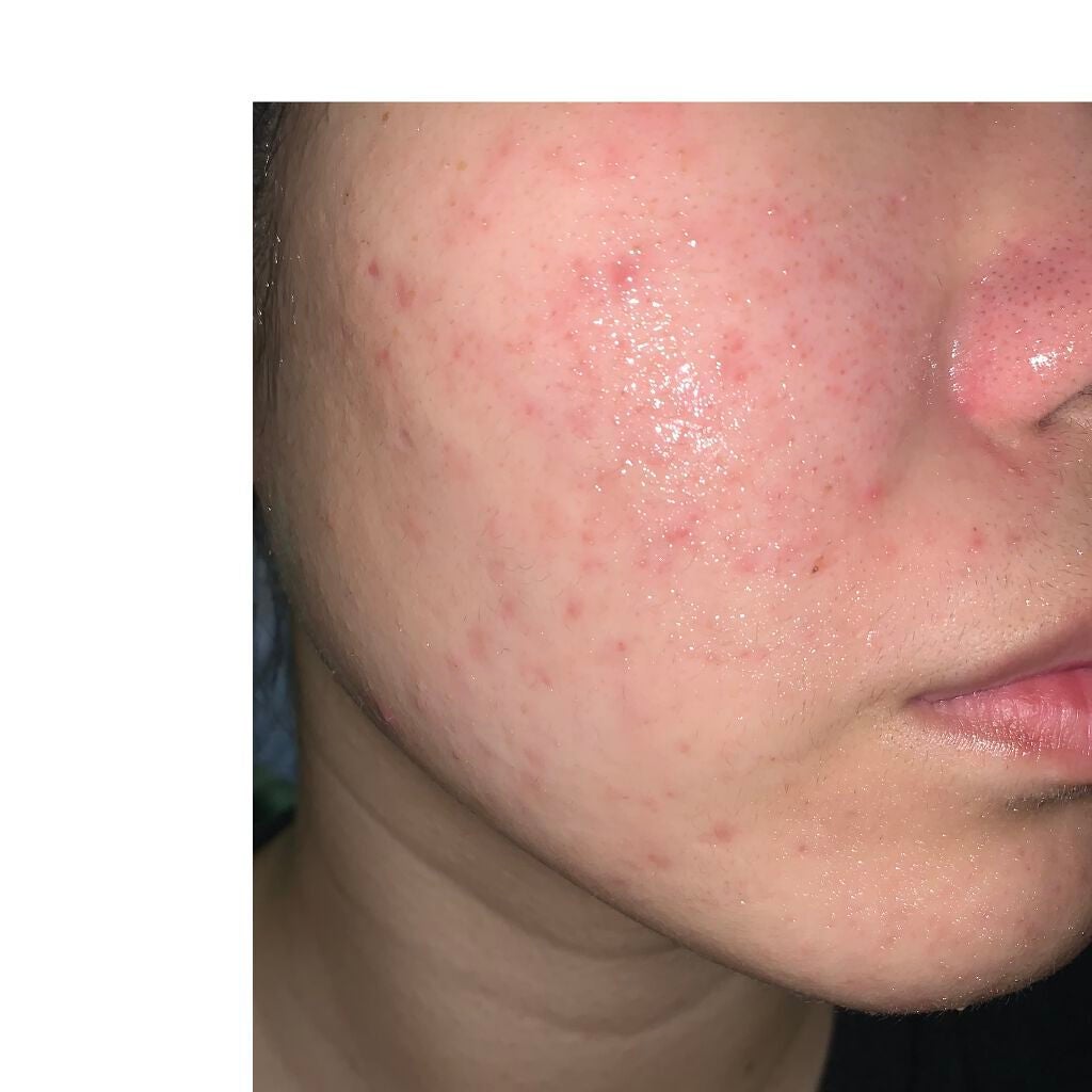 薬用しみ対策 美白化粧水/メラノCC/化粧水を使ったクチコミ(2枚目)