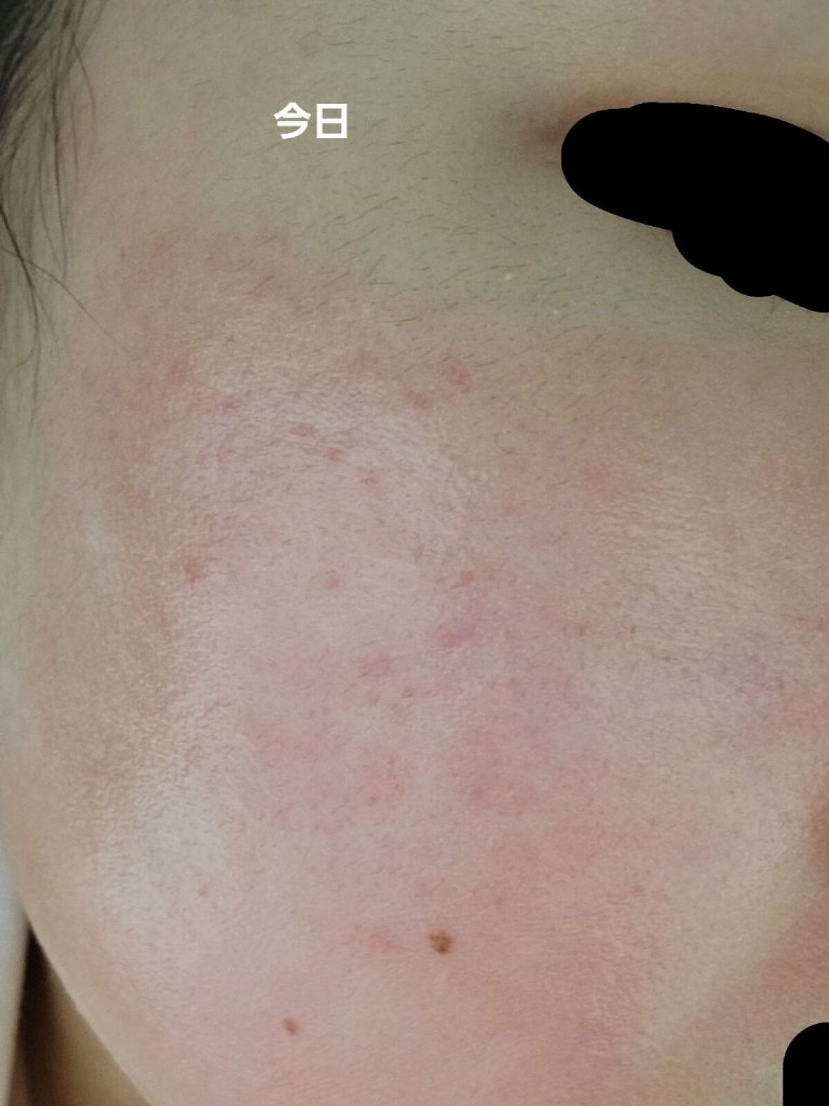 ハトムギ化粧水(ナチュリエ スキンコンディショナー R )/ナチュリエ/化粧水を使ったクチコミ（1枚目）