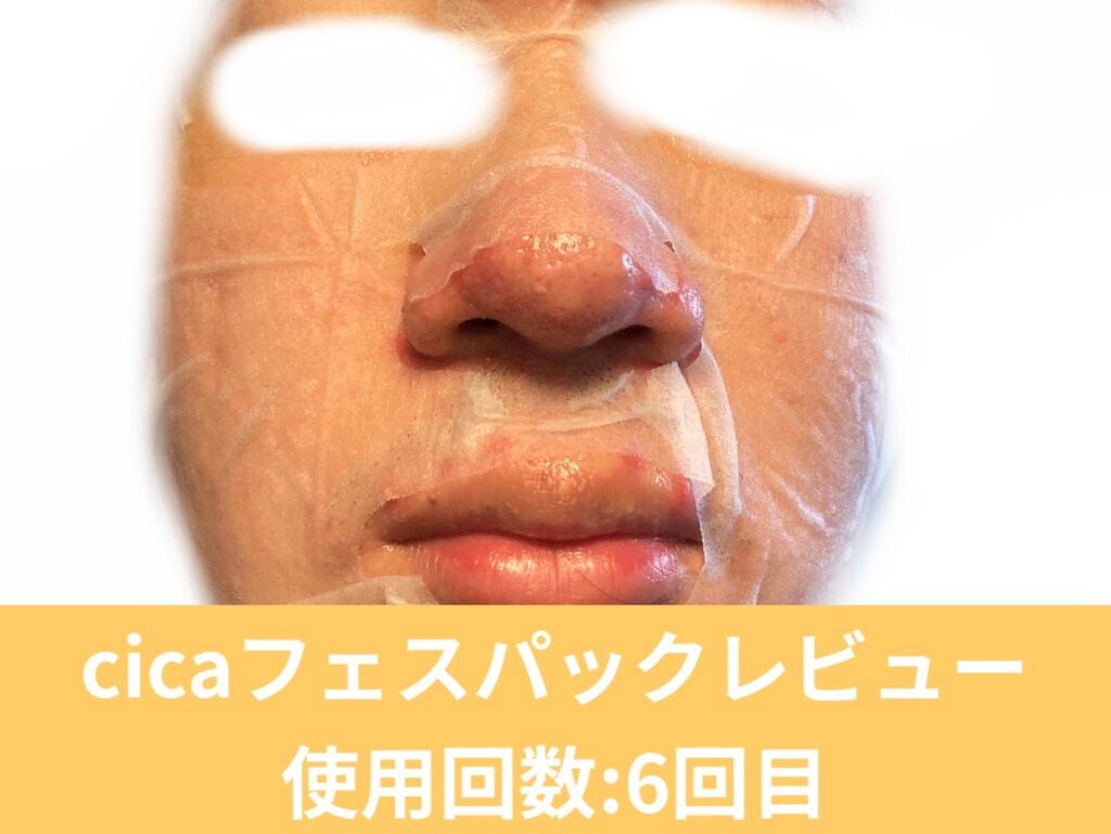 (フォロバ)3年後に韓国美男子 on LIPS 「CICA×HYALONフェスパック使用回数:6枚目RISMフェ..」(1枚目)