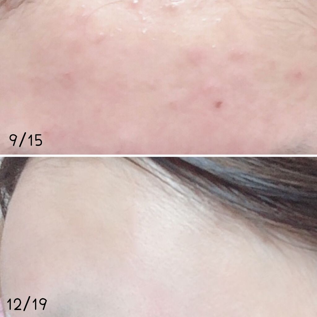 1本満足バー プロテイン/1本満足バー/プロテインバーを使ったクチコミ（2枚目）