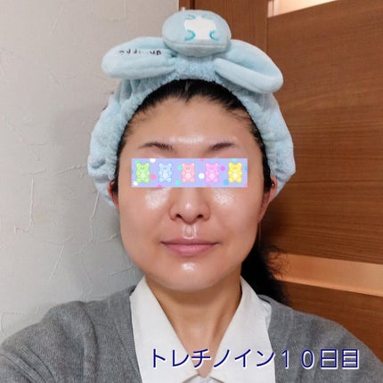 極潤α リフトクリーム/肌ラボ/フェイスクリームを使ったクチコミ(1枚目)