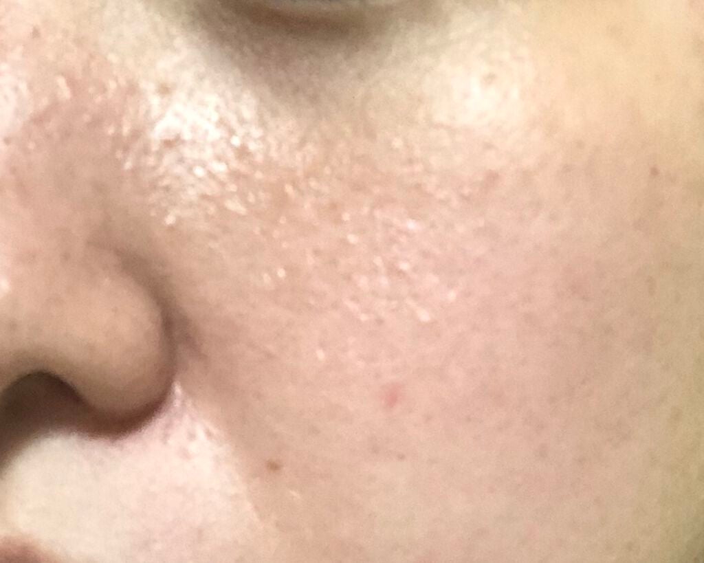 かや on LIPS 「助けて下さい(スキンケア)⚠️写真閲覧⚠️助けて下さい…🙇♂..」(4枚目)