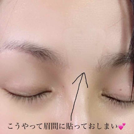 ミケンディープパッチ/北の快適工房/シートマスク・パックを使ったクチコミ(4枚目)