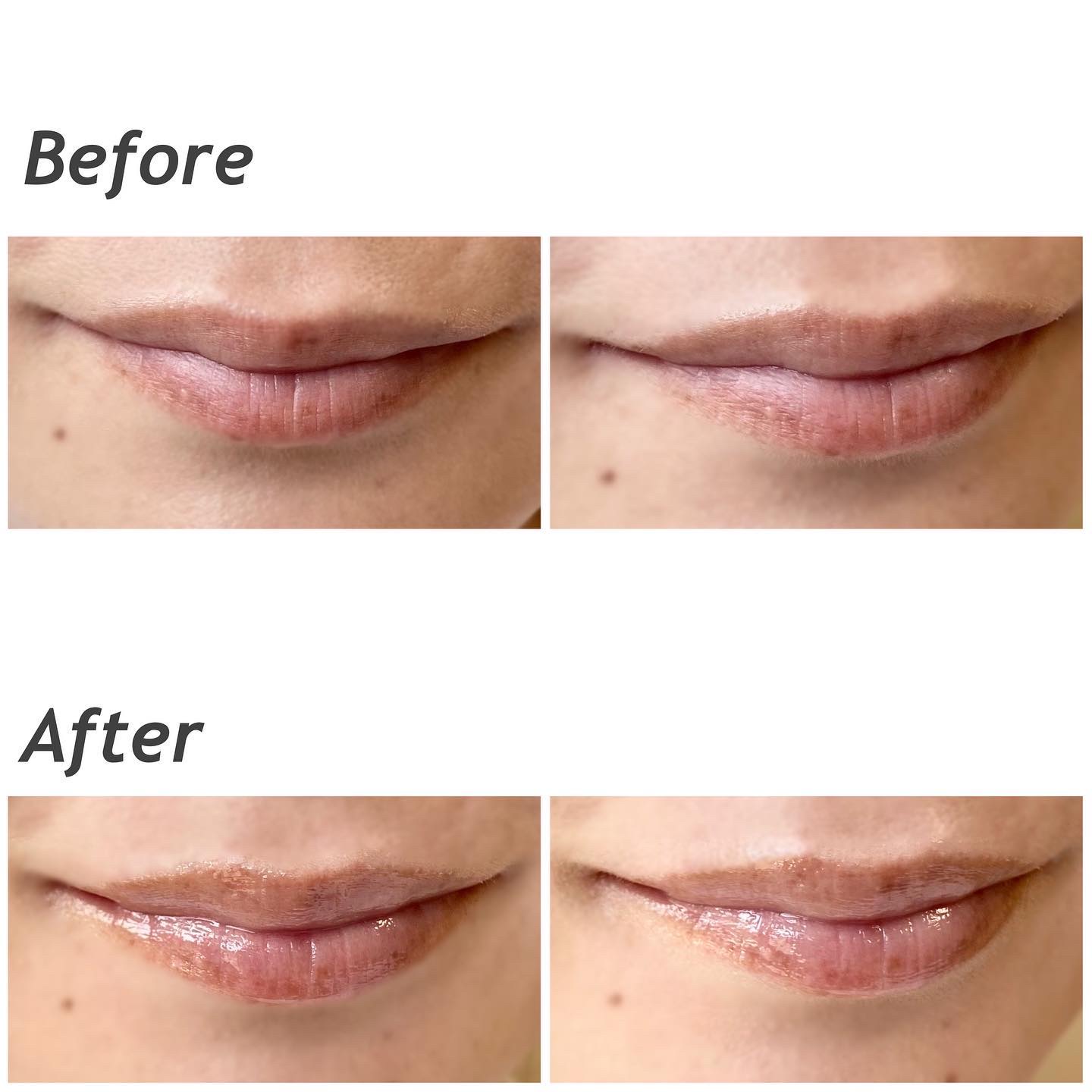 モイストリップバーム/XOUL/リップバームを使ったクチコミ（3枚目）