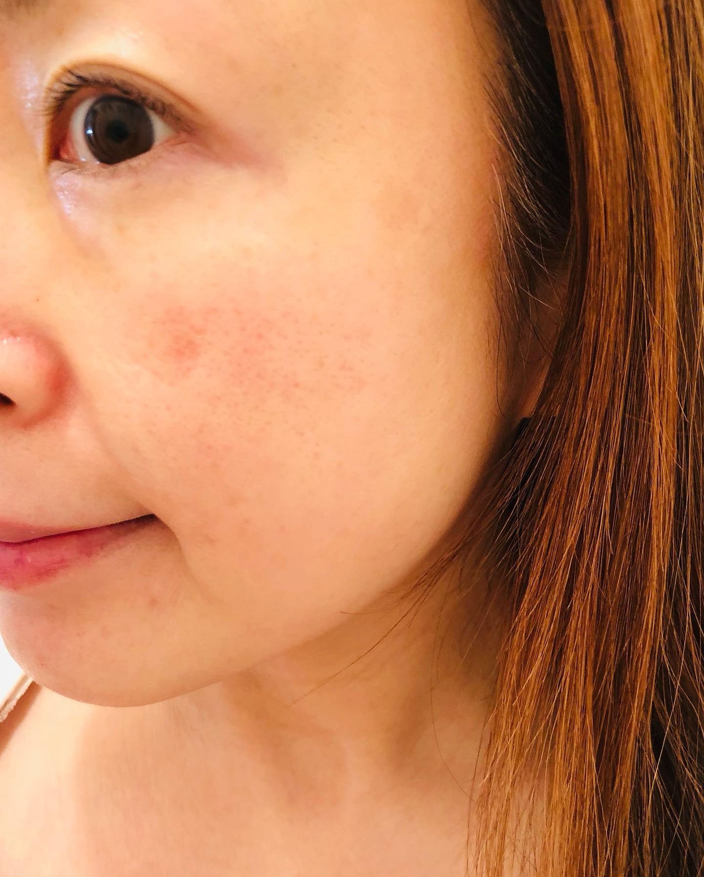 Peeling Ampoule 19.5/BeginS by JUNGSAEMMOOL/ピーリングを使ったクチコミ(7枚目)