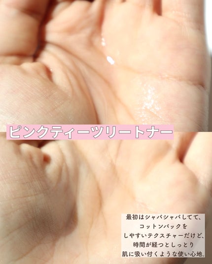 ピンクティーツリートナー/APLIN/化粧水を使ったクチコミ(3枚目)