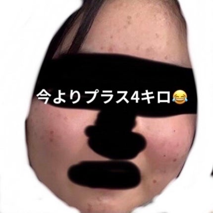 ペアアクネクリームW(医薬品)/ペア/その他を使ったクチコミ(2枚目)