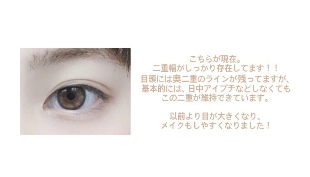 グリーンティーシード アイ＆フェイスボール/innisfree/美容液を使ったクチコミ（3枚目）