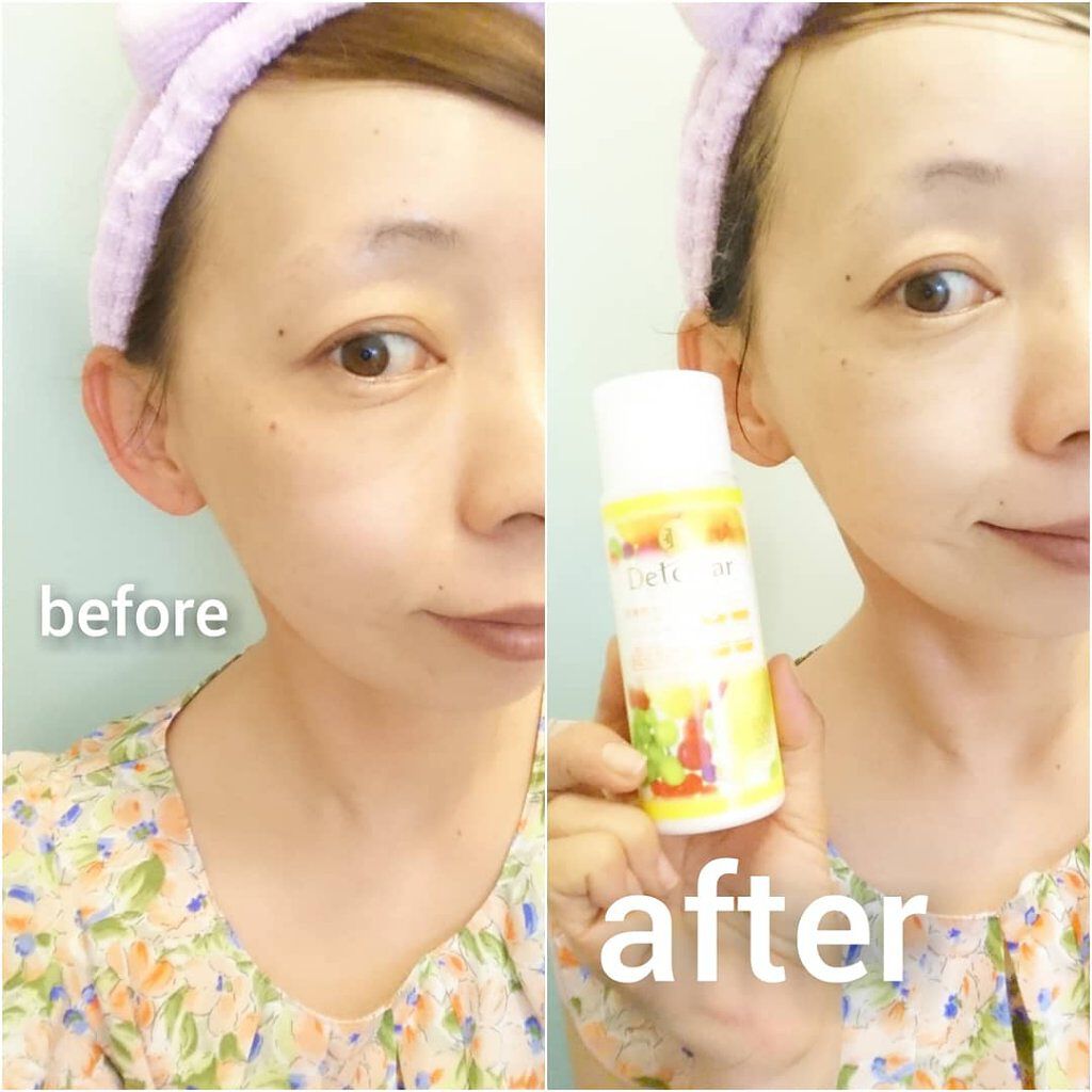 Detclear DETクリア ブライト＆ピール ピーリングジェリー<ミックスフルーツの香り>のクチコミ「DETクリア酵素洗顔 

パパイン酵素洗顔パウダー

毛穴のお掃除

お肌も喜ぶクリーニング🖤.....」（2枚目）