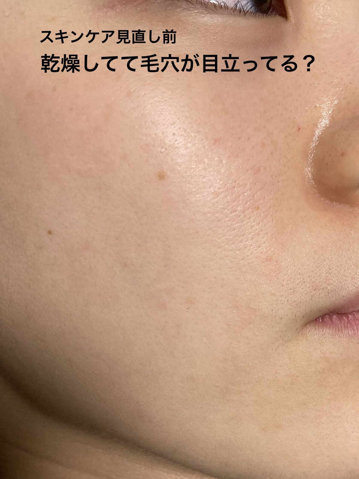 試してみた】APEX アペックス セラム 913の効果・肌質別の口コミ