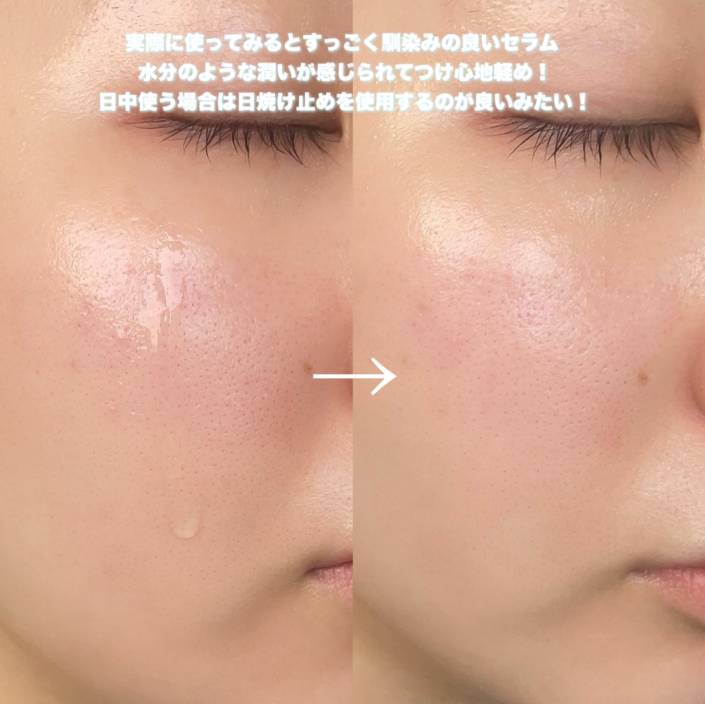 フレッシュリージュースドビタミンチャージングセラム(30ml)/Klairs/美容液を使ったクチコミ(5枚目)