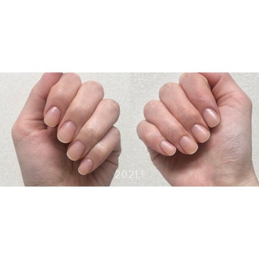 無印良品 スウィートアーモンドオイルのクチコミ「💅育爪経過報告💅


12月 → 1月


引き続きショートネイルです。

緊急事態宣言のせい.....」（1枚目）