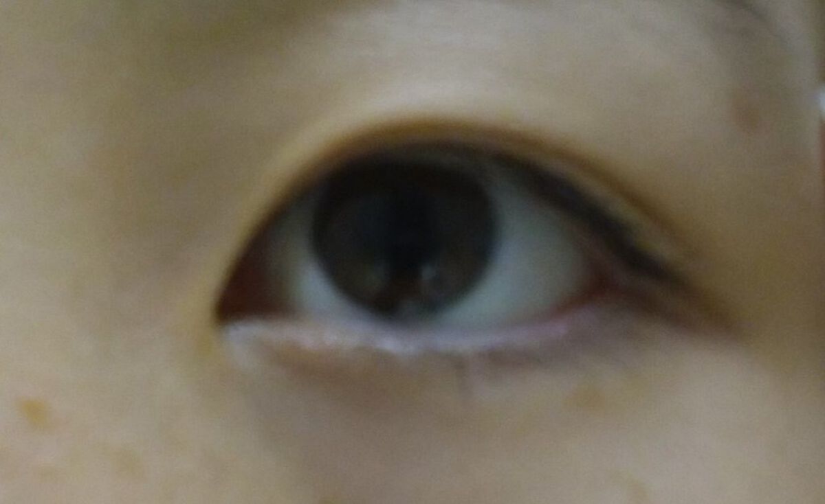 アイビューティー フィクサー WP/アストレア ヴィルゴ/二重まぶた用アイテムを使ったクチコミ（3枚目）