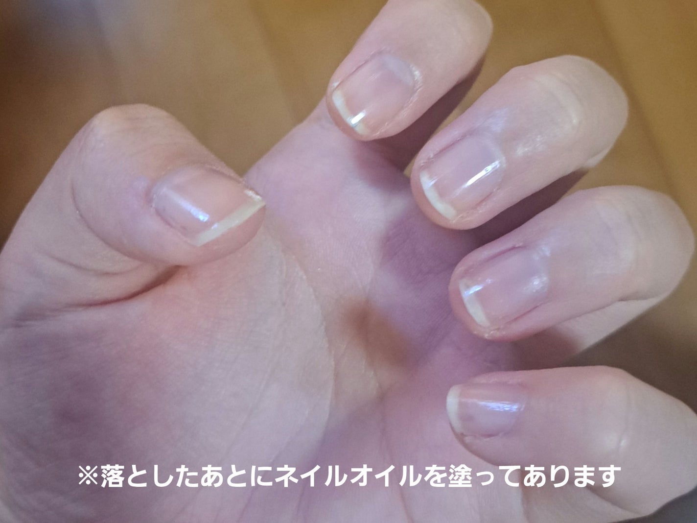 ノンアセトンネイルリムーバー/DAISO/除光液を使ったクチコミ(2枚目)