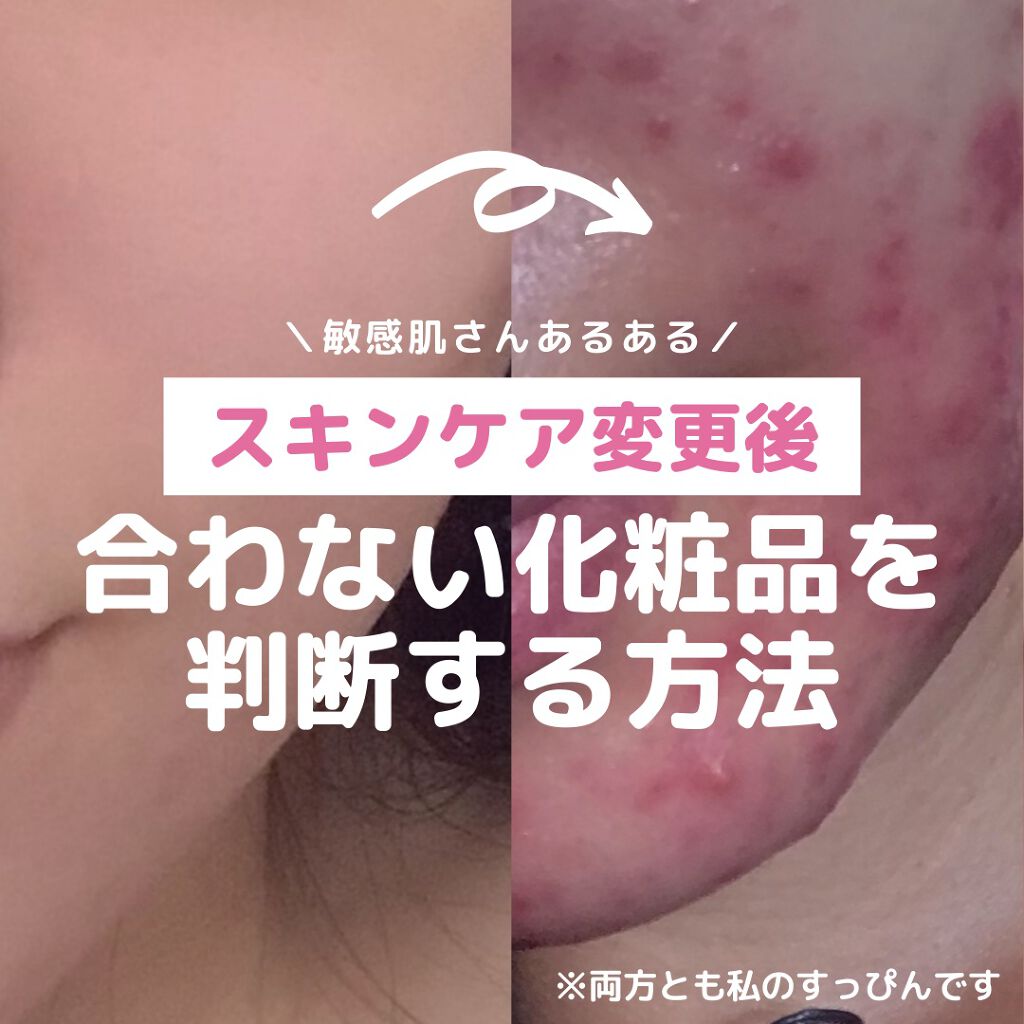 ガスール固形/ナイアード/洗顔石鹸を使ったクチコミ（1枚目）