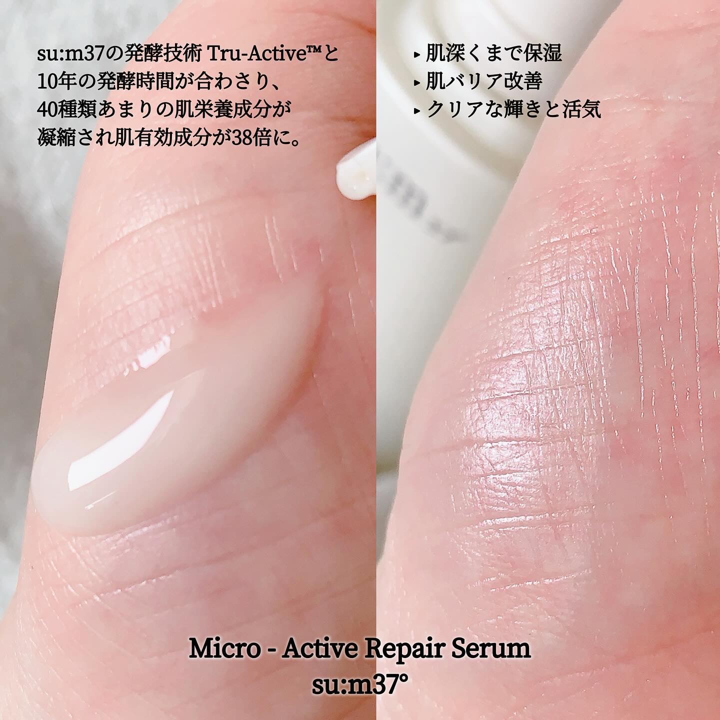 マイクロアクティブ リペアセラム/su:m37°/美容液を使ったクチコミ（2枚目）