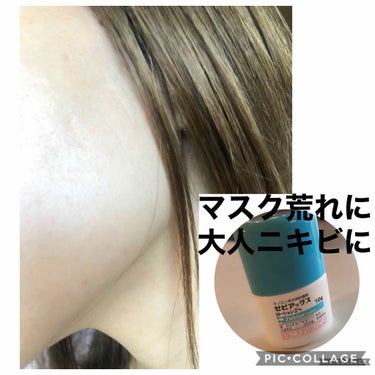 ゆきまま on LIPS 「ゼビアックス💊マルホ株式会社　　ゼビアックス皮膚科で処方しても..」（1枚目）