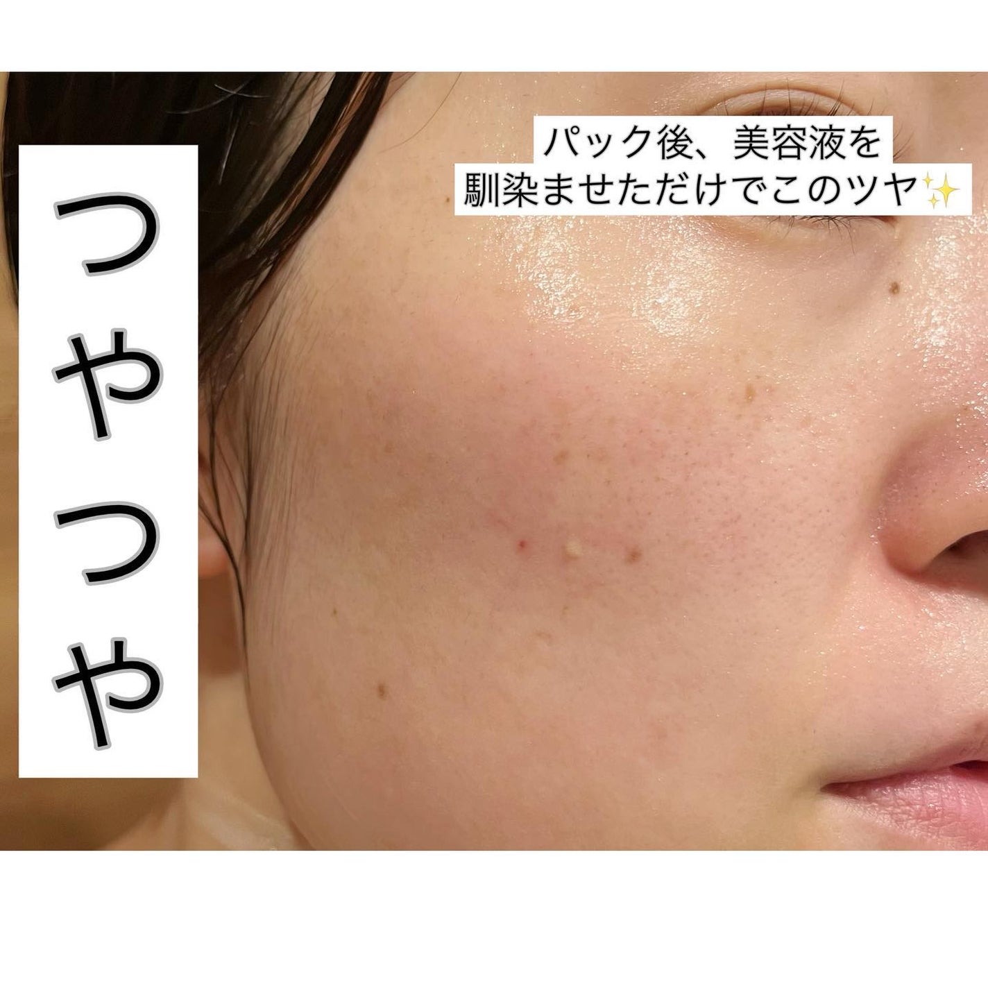 ホワイト ゼリー マッシュルーム エラトックス マスク/BYLIMU/シートマスク・パックを使ったクチコミ(3枚目)