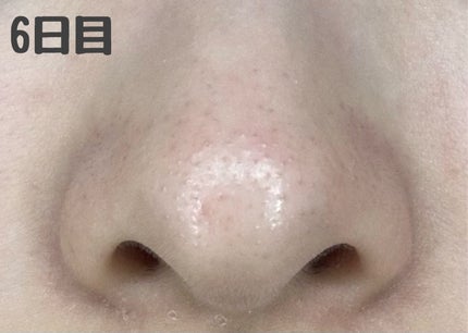 デュオ ザ クレンジングバーム ブラックリペア /DUO/クレンジングバームを使ったクチコミ(7枚目)