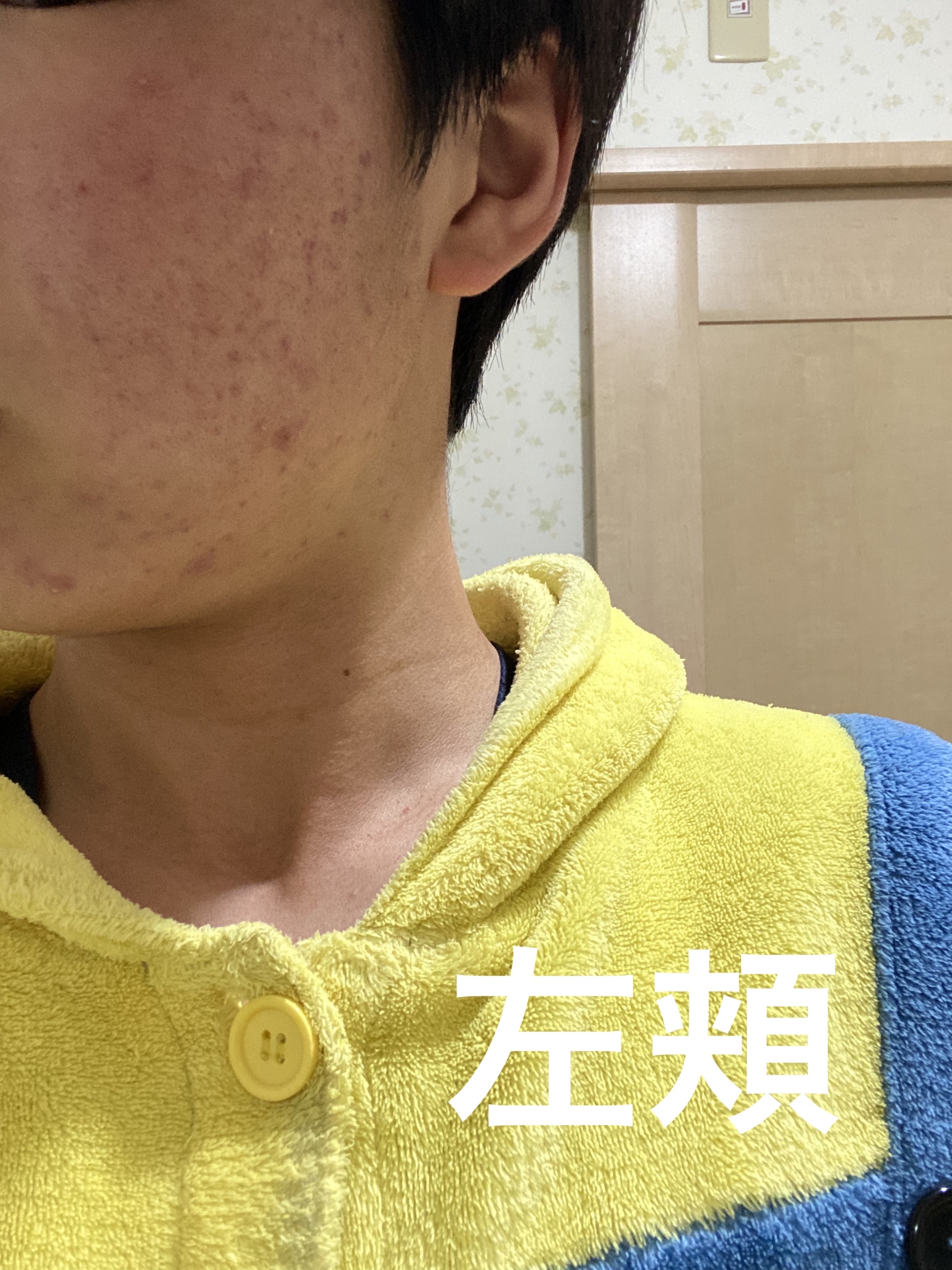 白潤プレミアム薬用浸透美白化粧水/肌ラボ/化粧水を使ったクチコミ（2枚目）