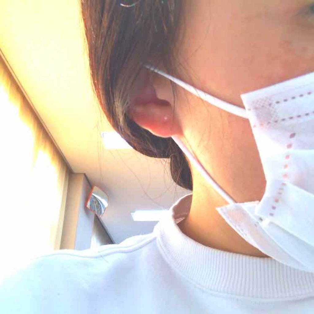 おさゆ on LIPS 「ピアッサー初めてピアスを開けました!!まずは痛みについて右は冷..」(2枚目)