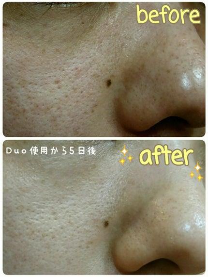 デュオ ザ クレンジングバーム クリア/DUO/クレンジングバームを使ったクチコミ(2枚目)