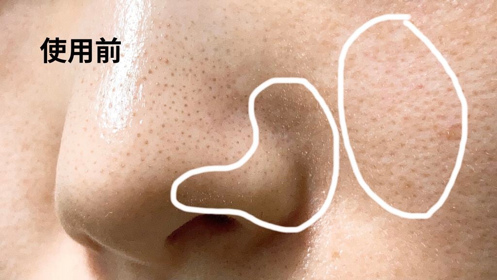 オバジC 酵素洗顔パウダー/オバジ/洗顔パウダーを使ったクチコミ(2枚目)