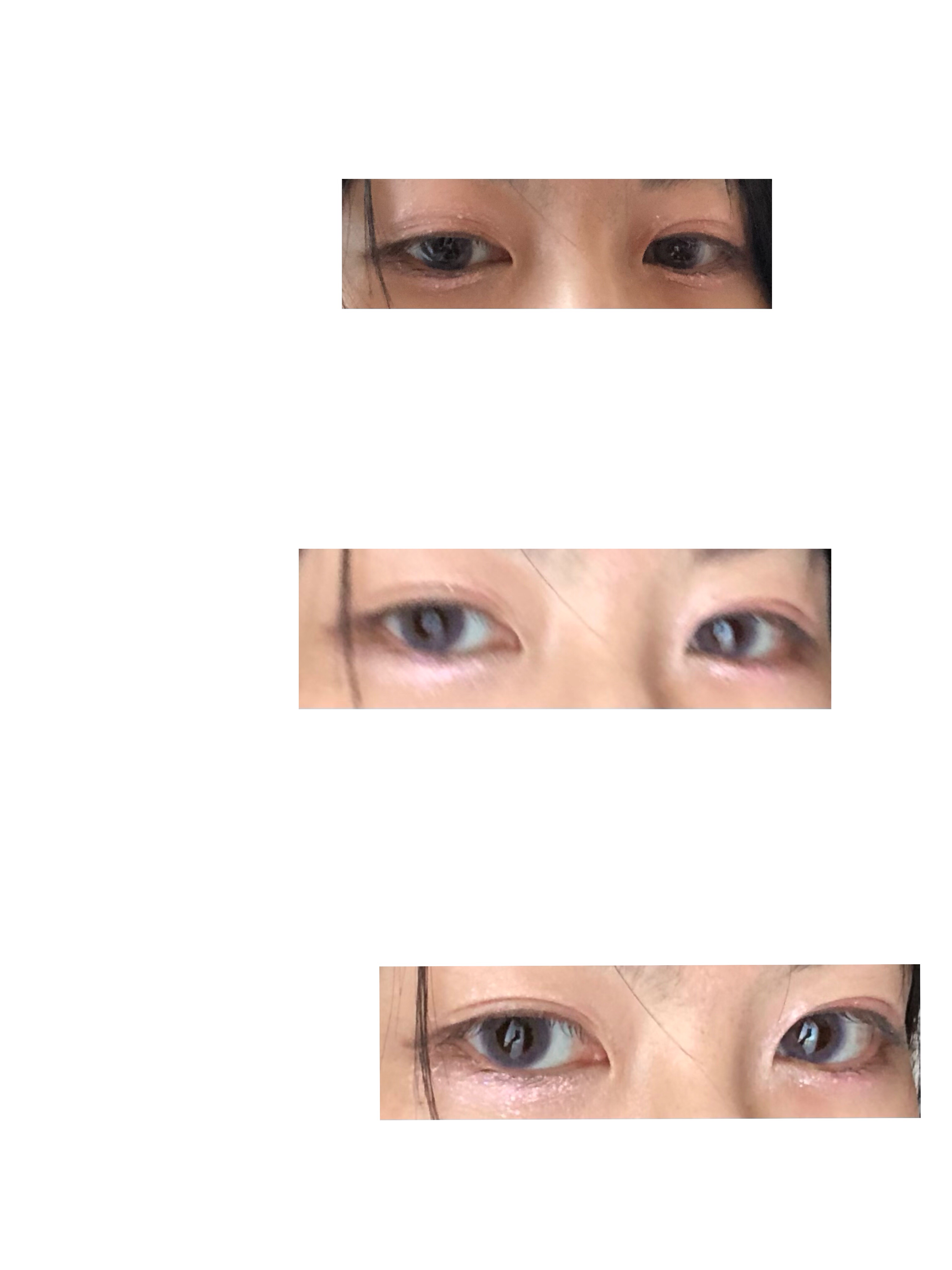 Angelcolor Bambi Series Vintage 1day/AngelColor/ワンデー（１DAY）カラコンを使ったクチコミ（2枚目）