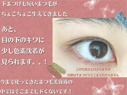 湘南美容まつ毛美容液/Co-medical+/まつげ美容液を使ったクチコミ(3枚目)