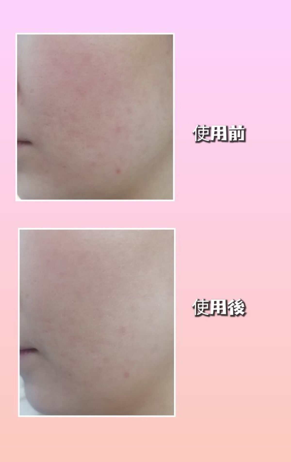 Qoo10/Qoo10/シートマスク・パックを使ったクチコミ(5枚目)