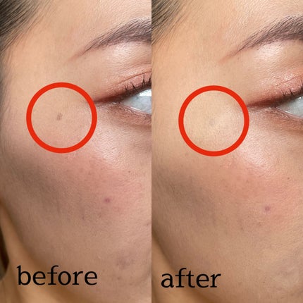 タトゥーウォータープルーフスカーコンシーラー/フォレンコス/リキッドコンシーラーを使ったクチコミ(7枚目)