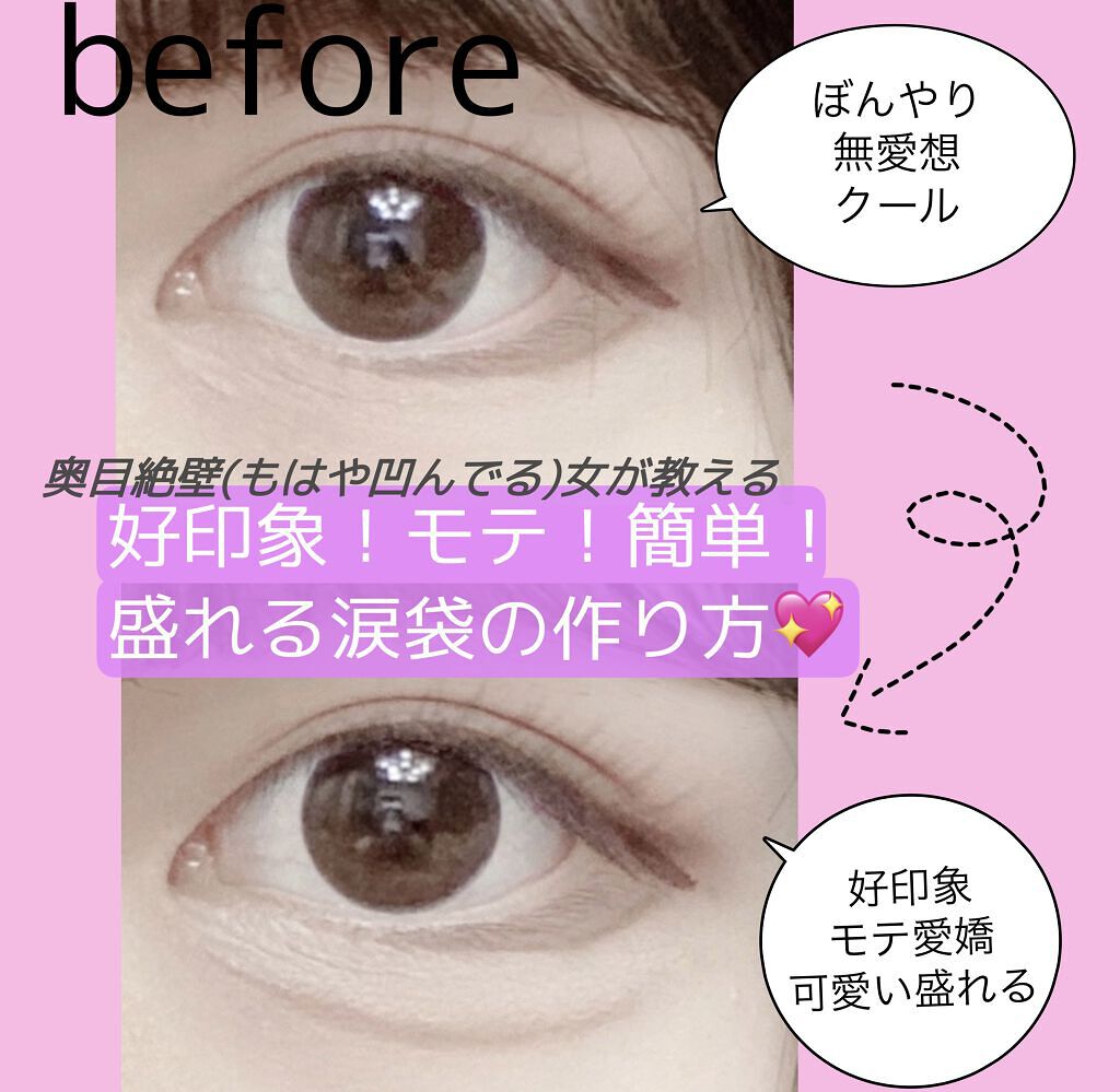 ロングラスティングチップコンシーラー/LUNA/リキッドコンシーラーを使ったクチコミ（1枚目）